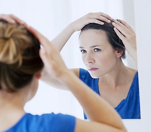 Hair loss. womanhairloss